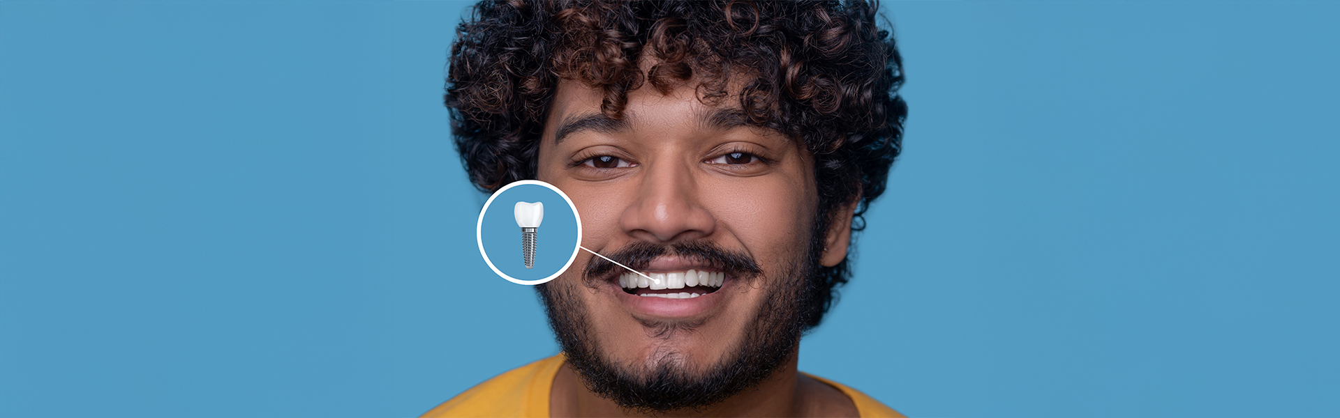 Can-dental-implants-get-infected